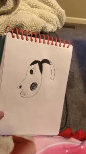 hyperpigmentation meme meme image